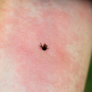Tick-borne illnesses are on the rise in Michigan