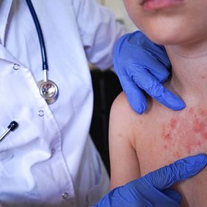 Recent spike in measles cases has health officials concerned as the new school year approaches