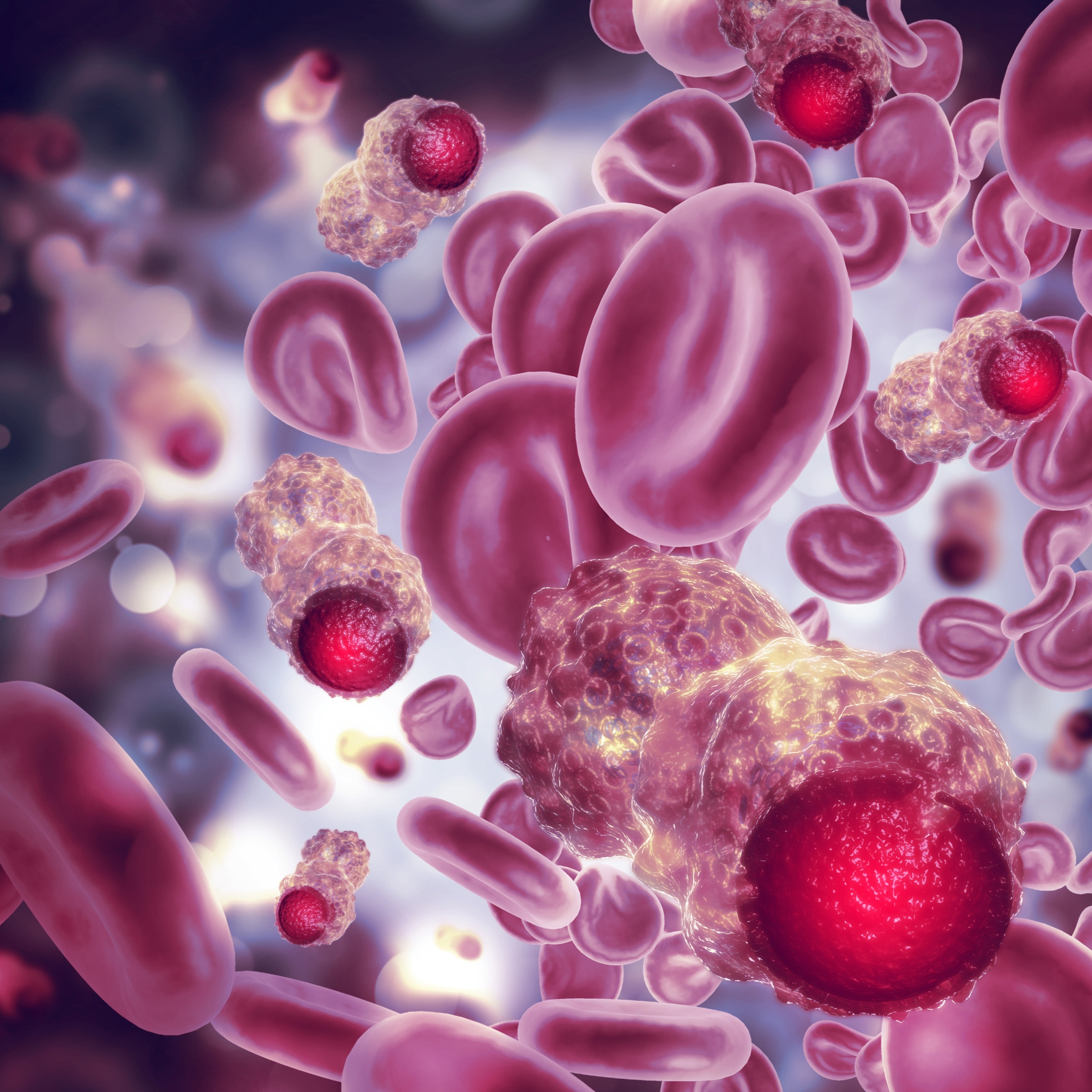 Blood Cancer and the 'Big Climb' with LLS - Amanda Singer