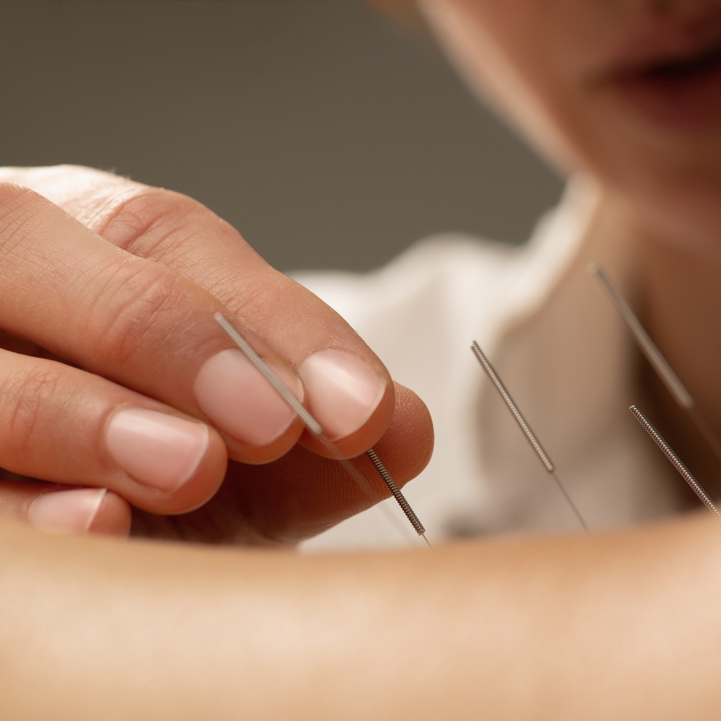 Nikki Vanecek, L.Ac. M.Ac.O.M.on Acupuncture!