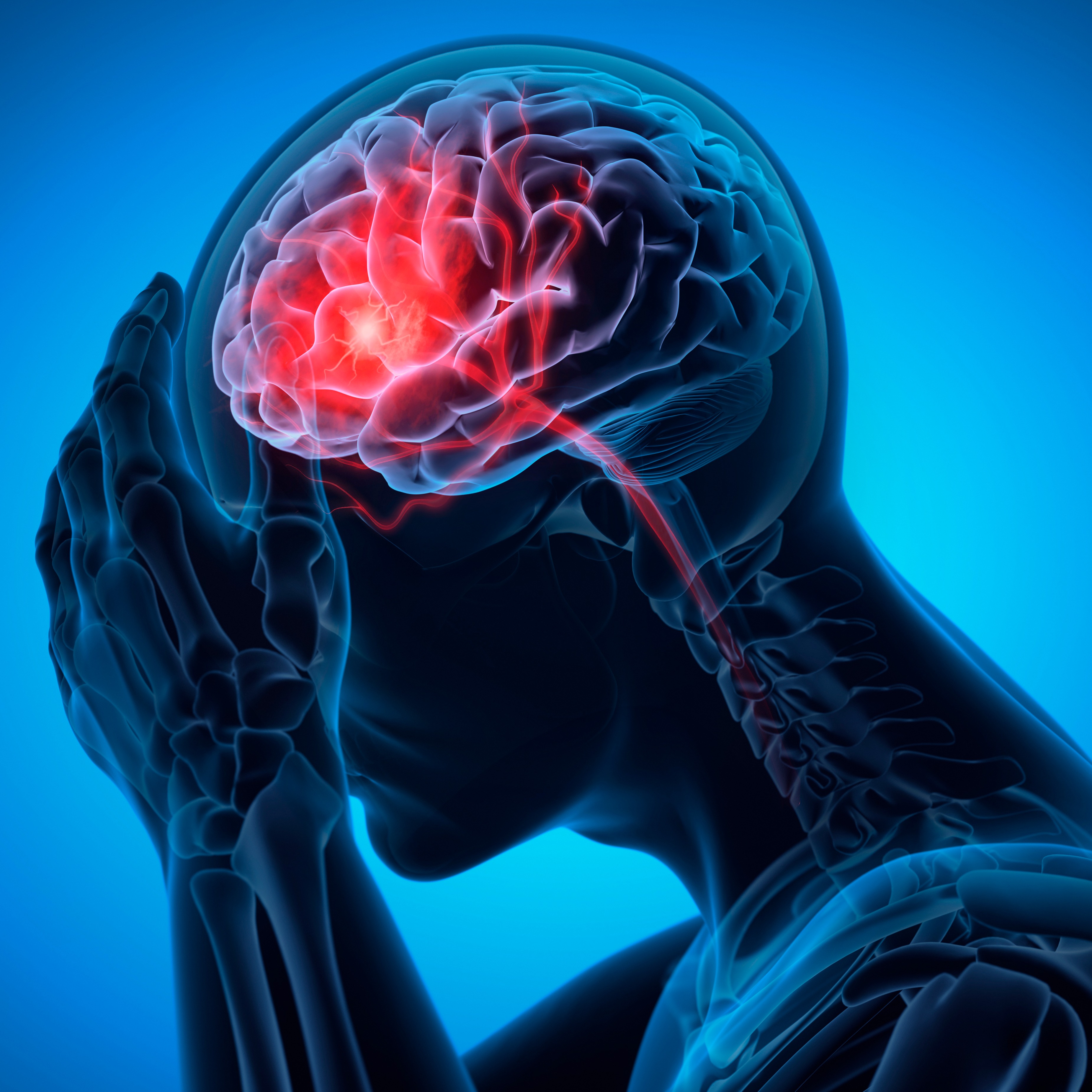 Headache vs. Migraine