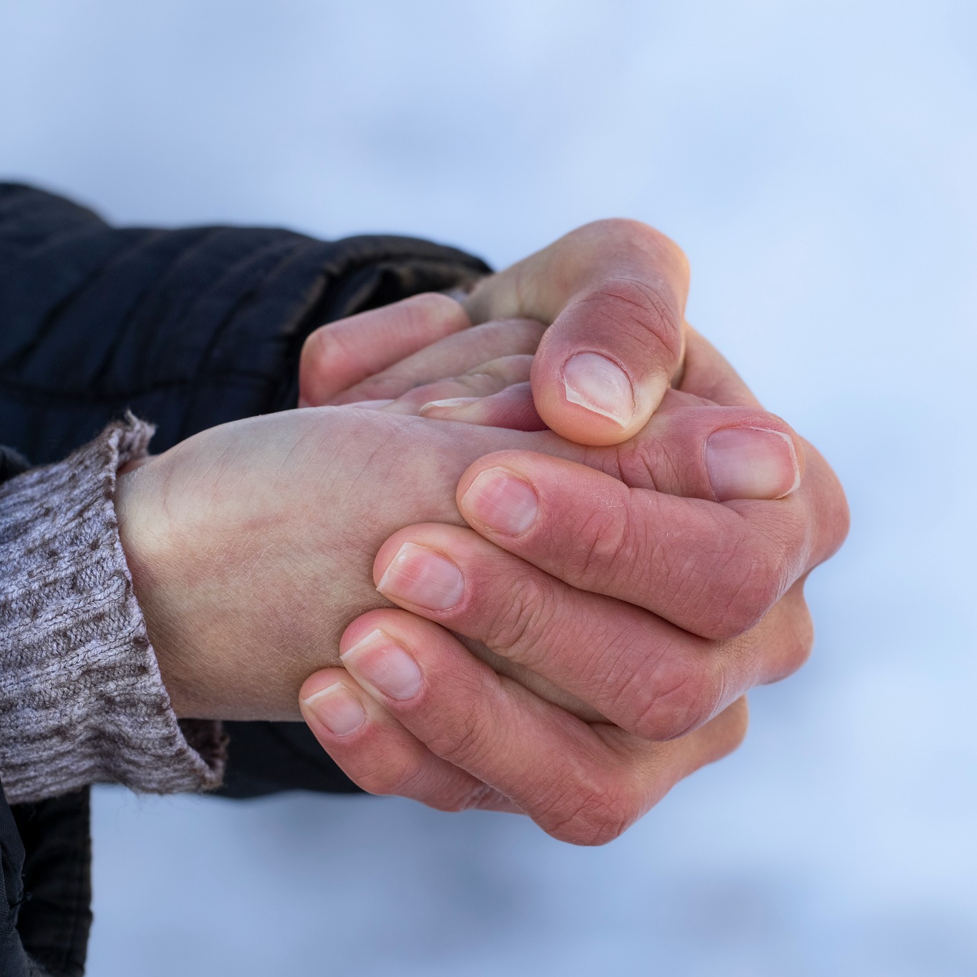 Talking Sleep with Dr. Stiehm, Bitter Cold/Frostbite with Jessie Nelson, MD!