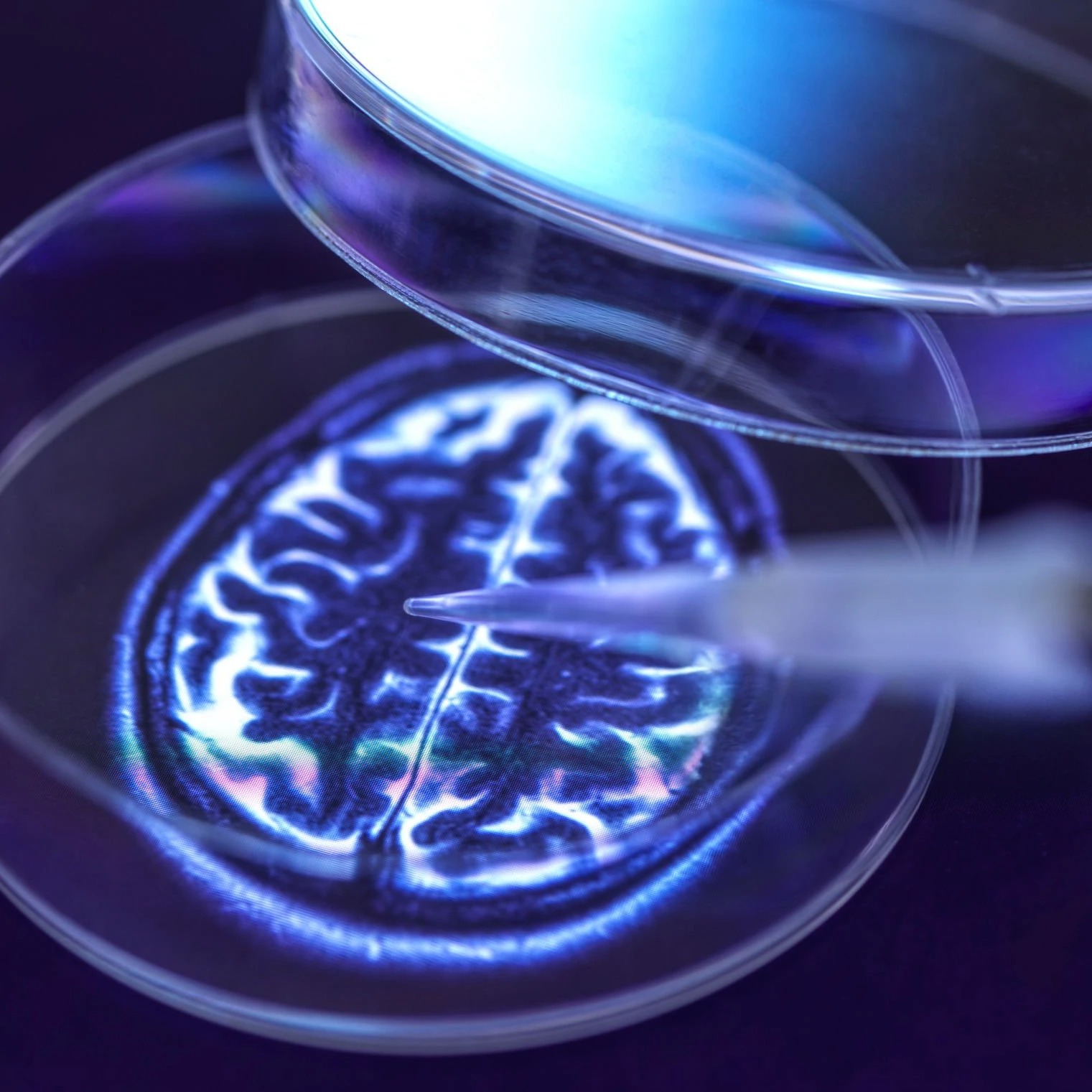 Weekly Dose and Ron Peterson, MD, PhD.. on Alzheimer’s and Dementia!