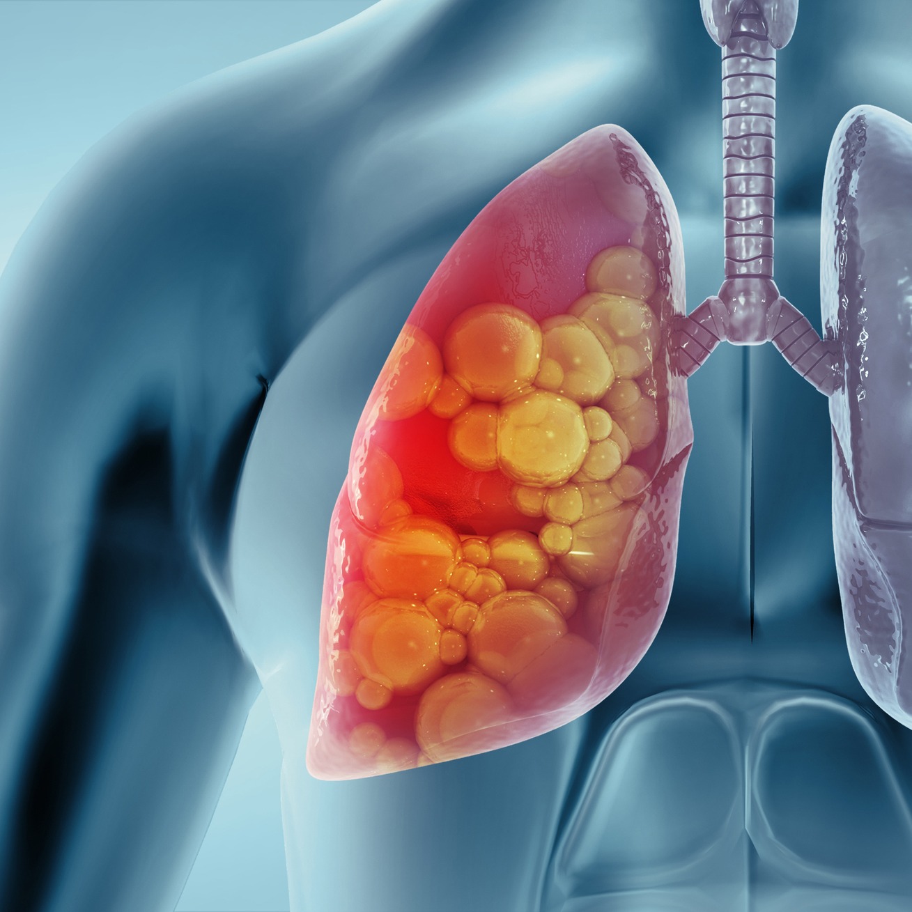 Lung and Pulmonary Health with A Breath of Hope!