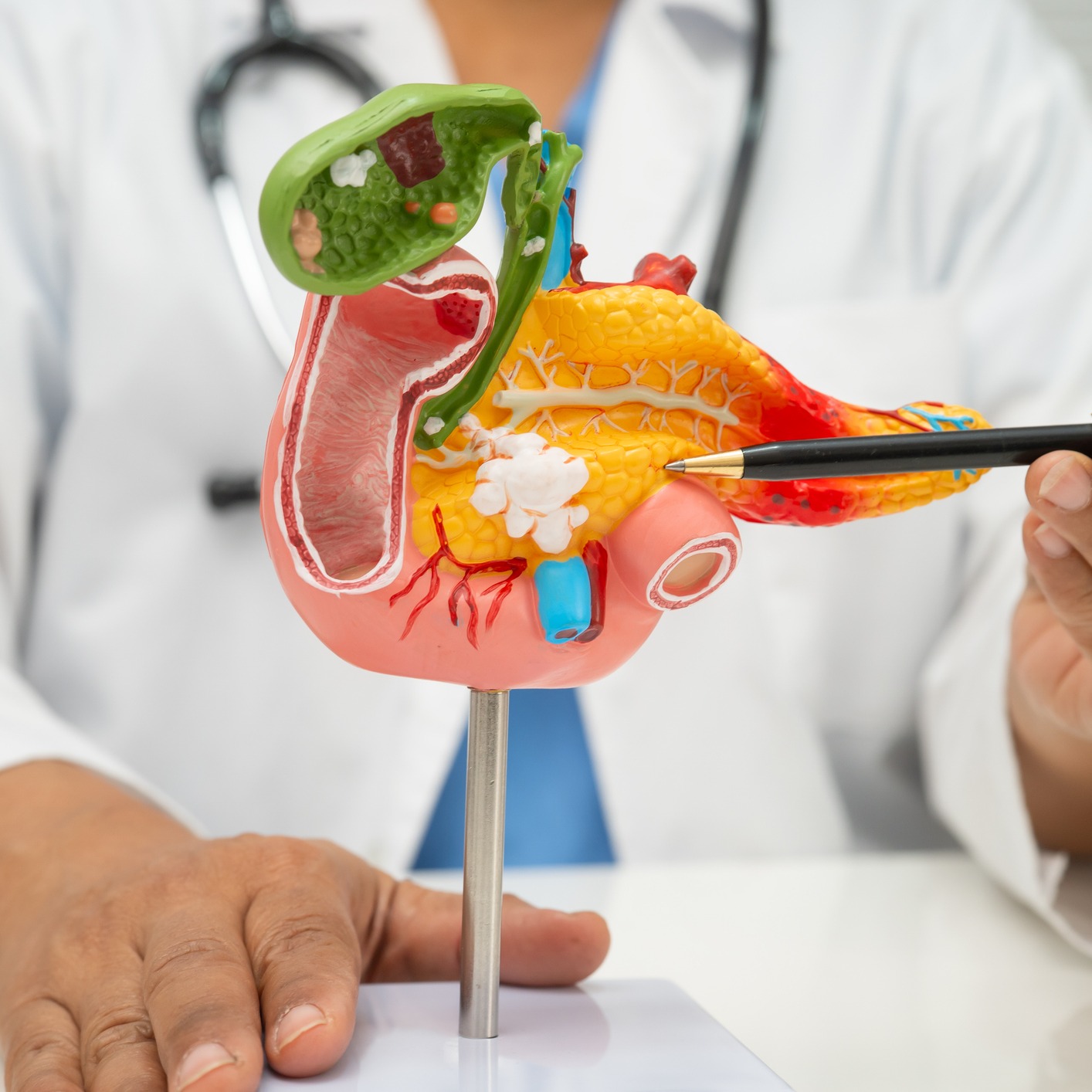 Weekly Dose, Battling Air Quality and Pancreatic Cancer Advancements!