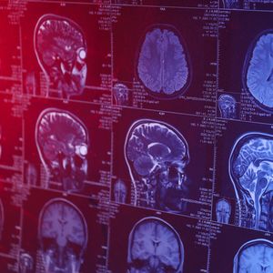 Dr. Sarah Song on maintaining brain health and neurology!