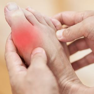 May 22 marks the 20th anniversary of Gout Awareness Day