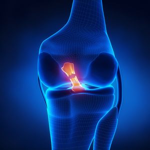 What IS an ACL injury? How long does it take to come back from?