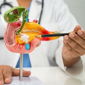 There's a new treatment for pancreatic cancer. Here's what to know