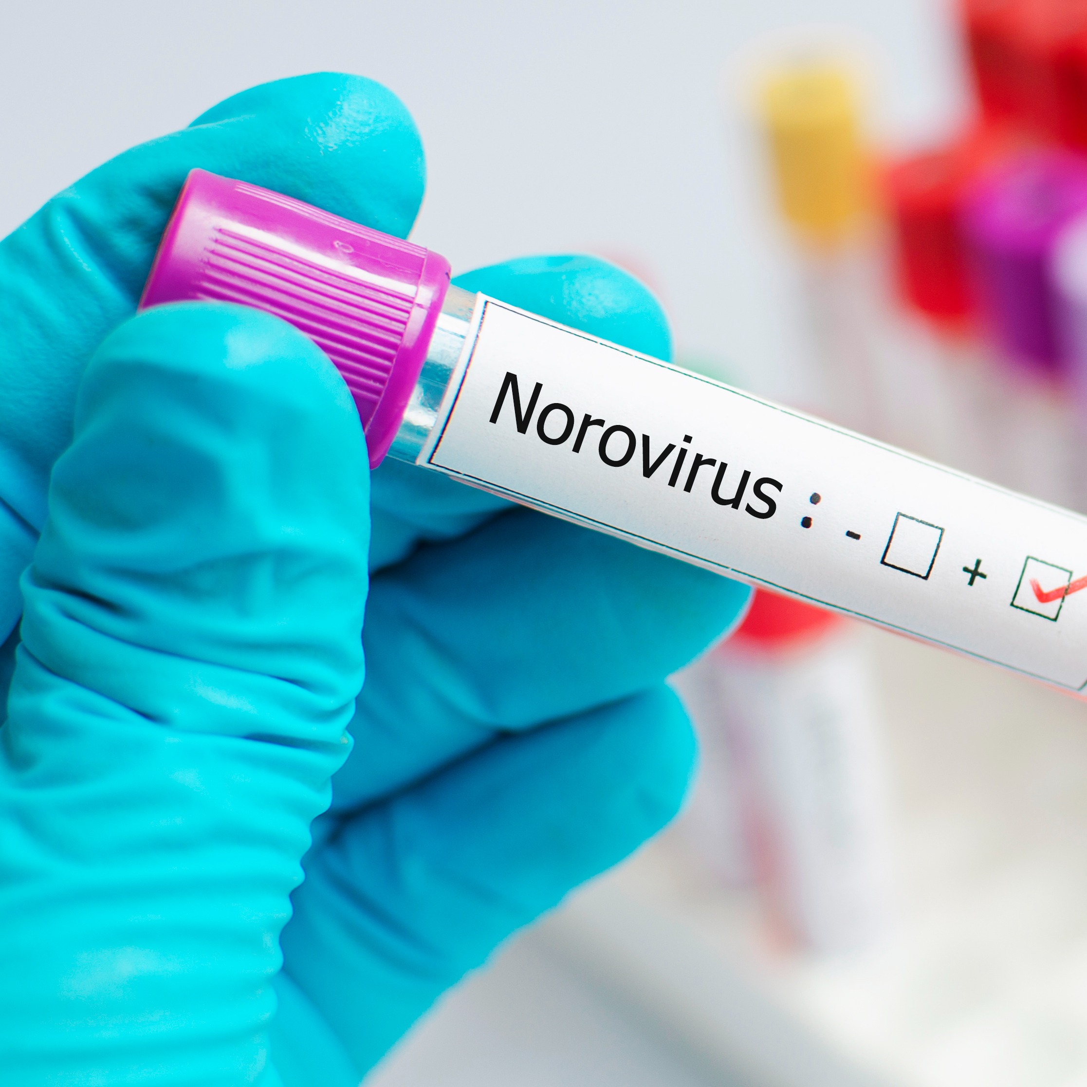 Why are we still so bad at basic contagious-illness etiquette?