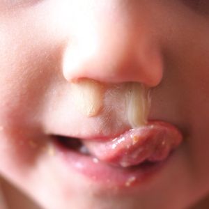 Ian Hoch Hour 3: Green Mucus Is Not Where It's At