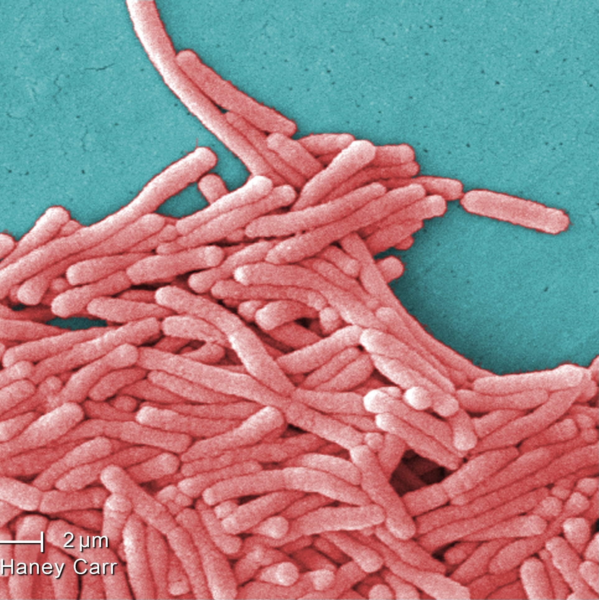 4th person dies from Legionnaire's disease in NYC
