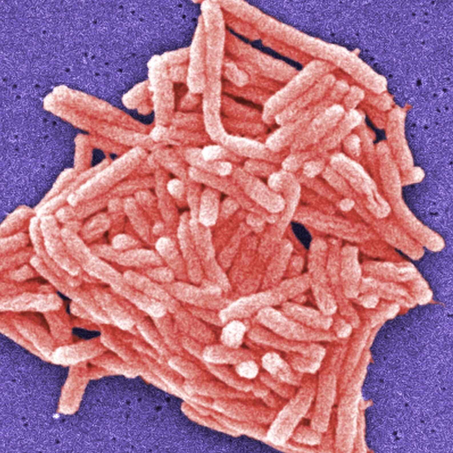 NYC Council questions city response to Legionnaires' outbreak; widow of victim considers lawsuit