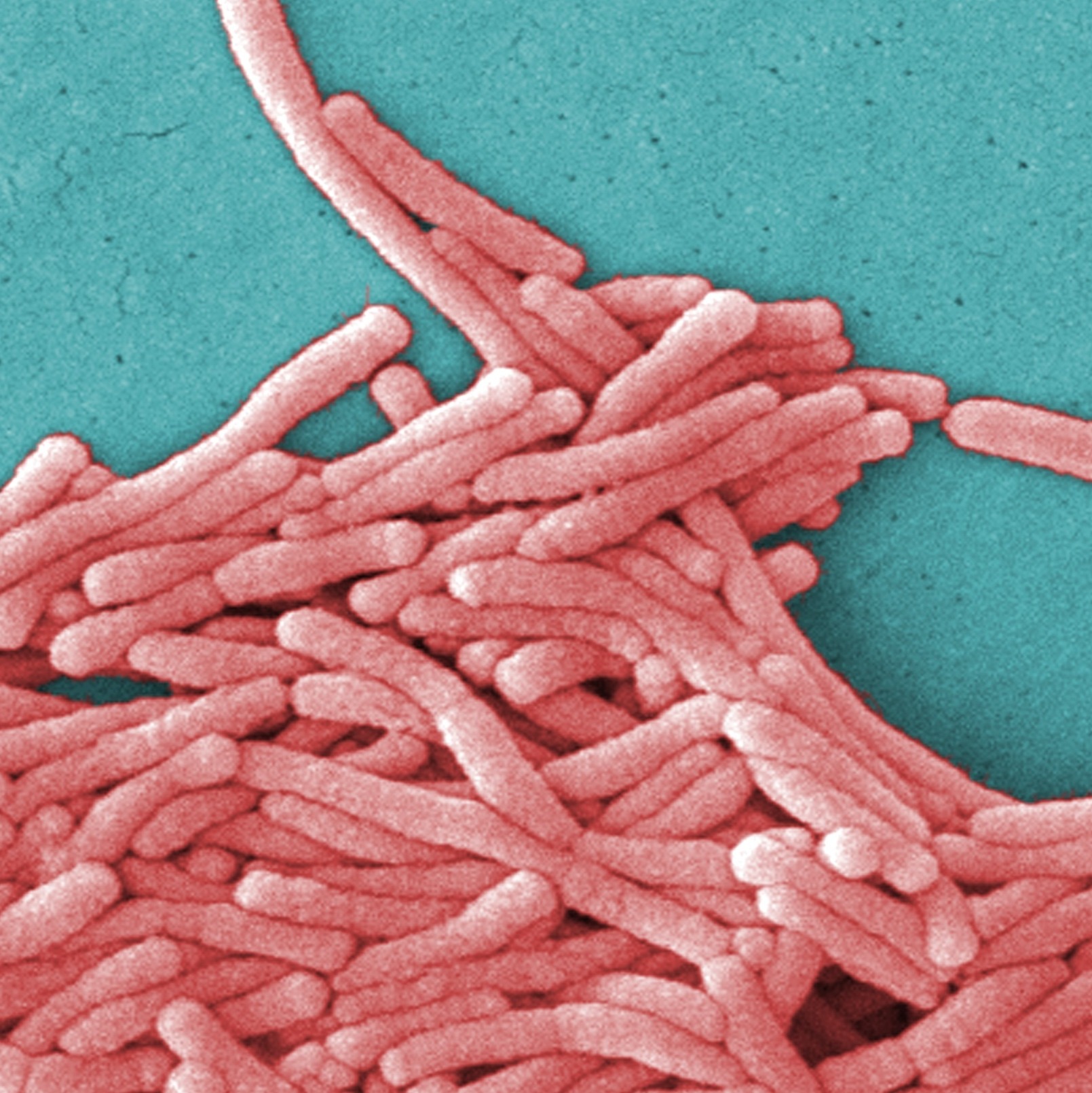 NYC appears to have 'eliminated the source of exposure' in Legionnaires' outbreak