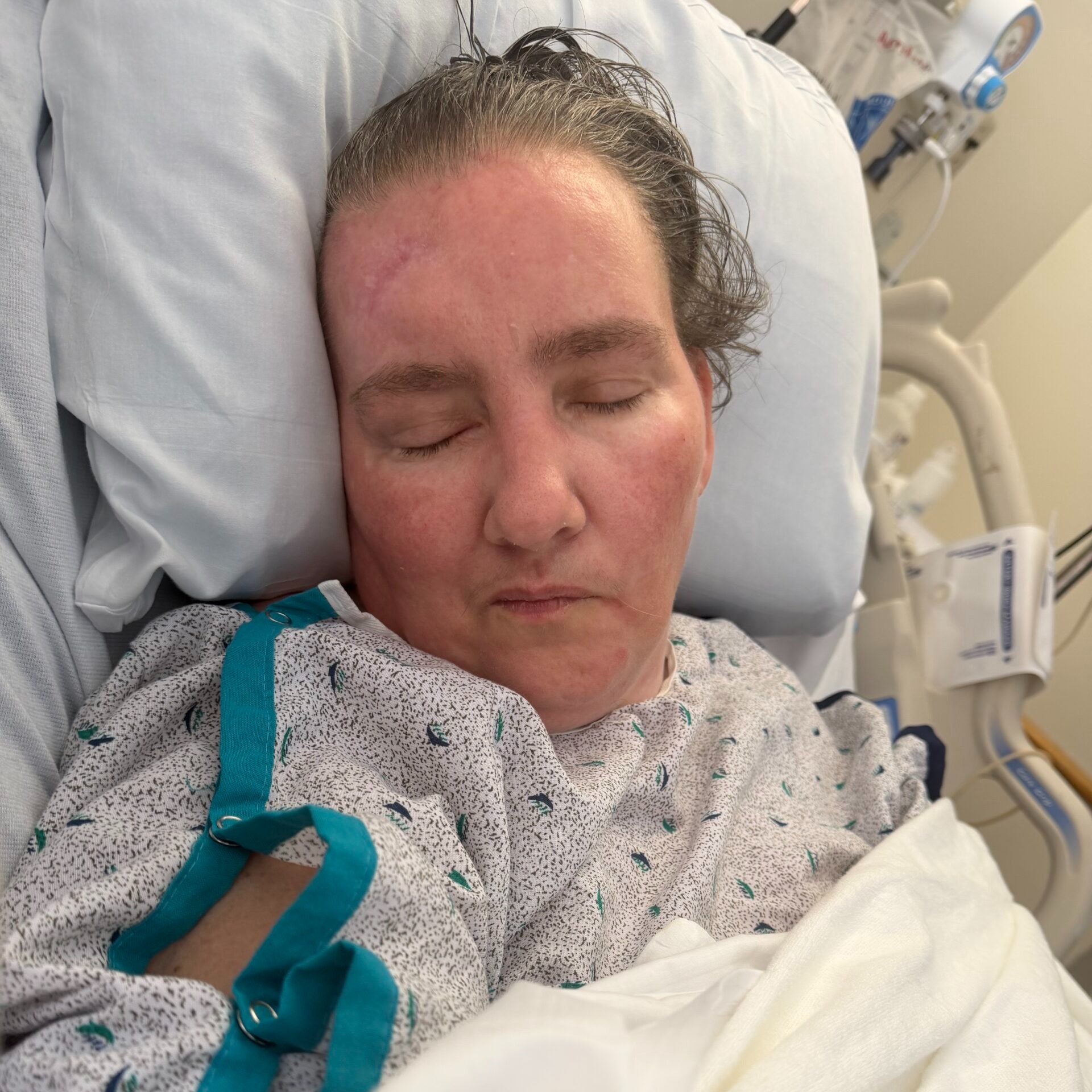 She was hit by a car a year ago and survived, but her identity remains a mystery to Philly police