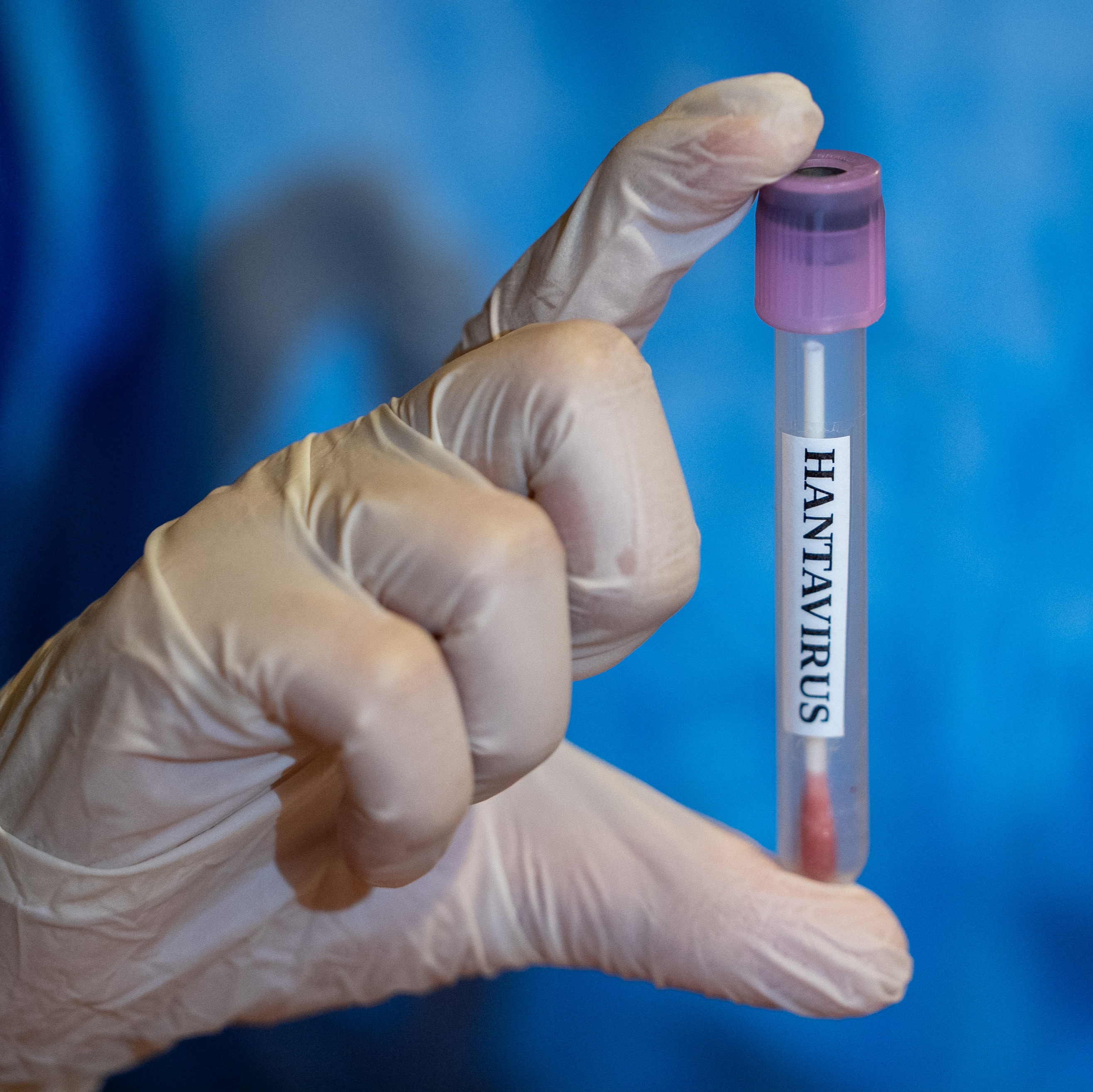2 NJ residents potentially exposed to person with hantavirus, officials say