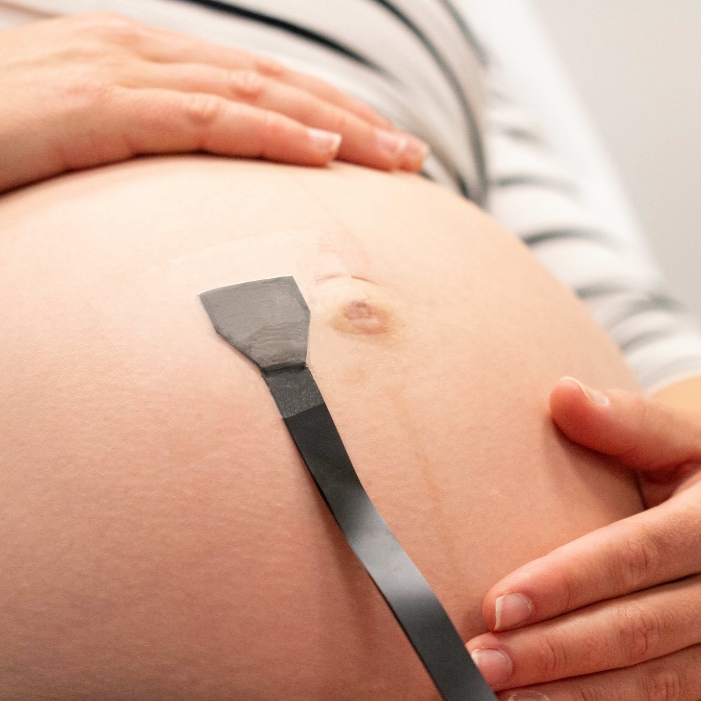Adhesive ultrasound patch helps spot pregnancy complications in real time