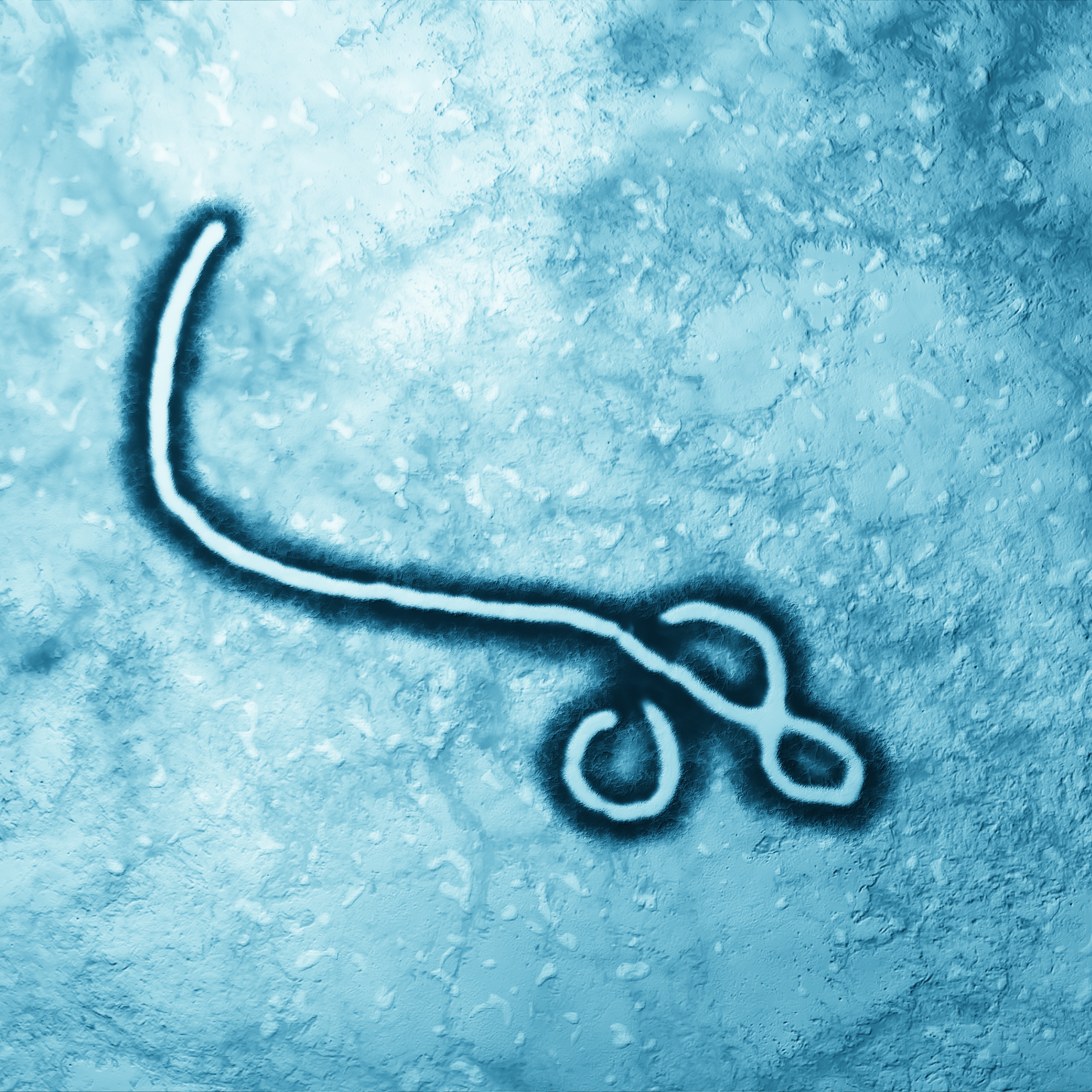 Taking a closer look at the current Ebola outbreak spreading through the Congo