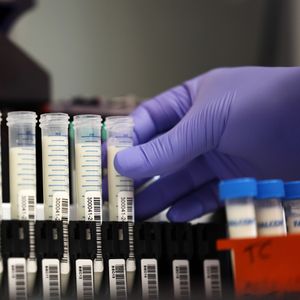 American universities face federal funding cuts that could impact future innovations