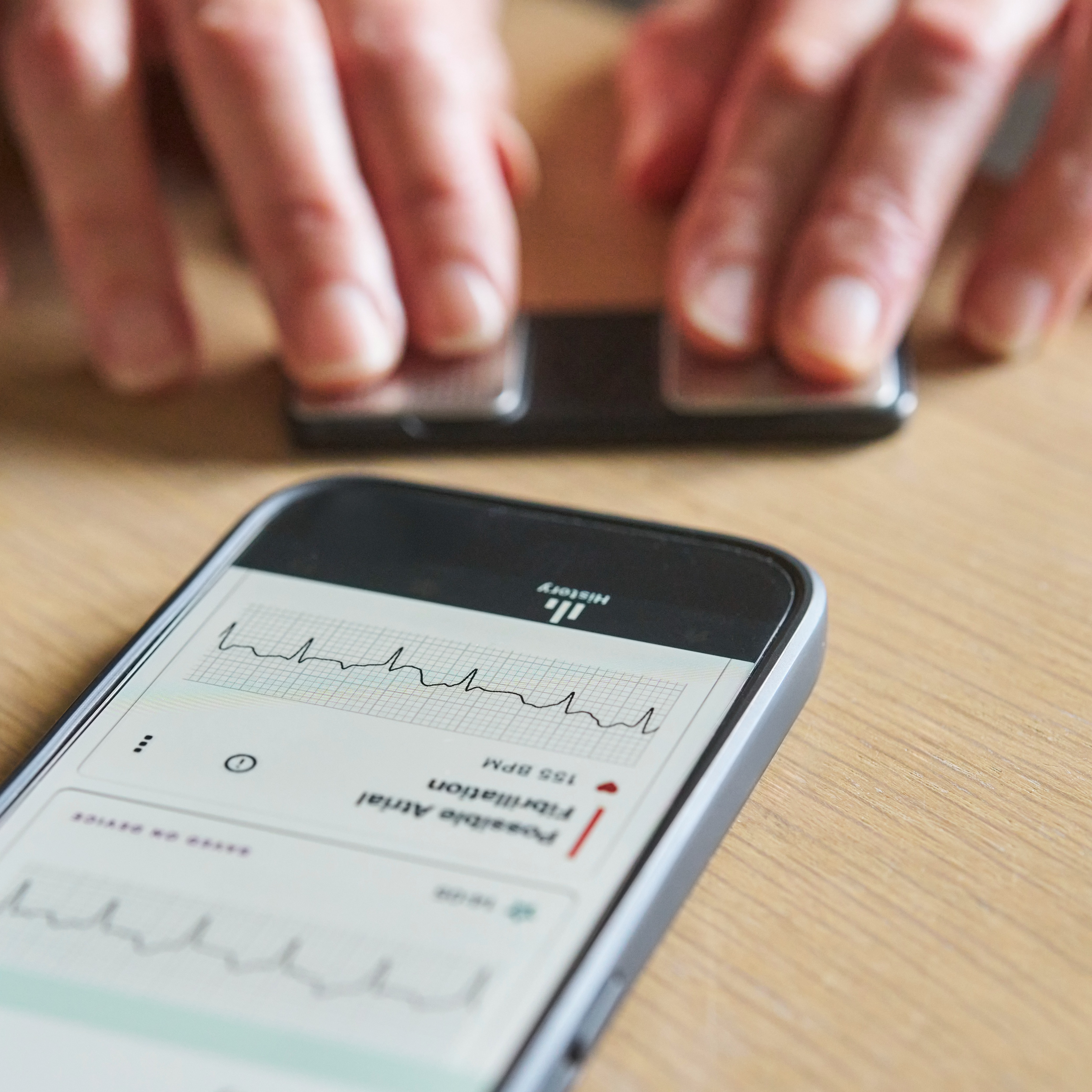 Diagnoses of atrial fibrillation are on the rise, experts say
