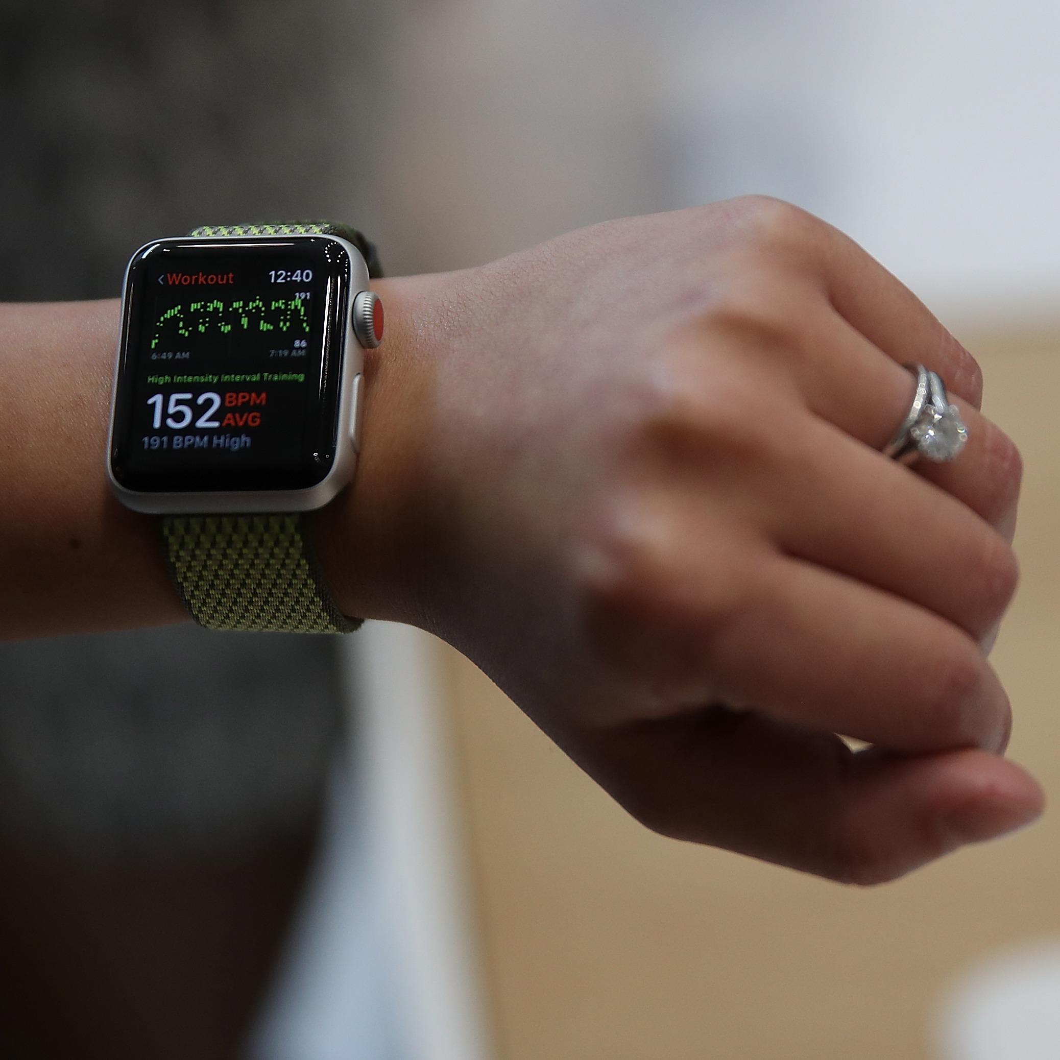 Wearable technology is helping more people detect irregular heart rates